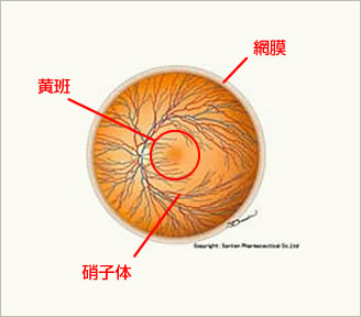 加齢黄斑変性について